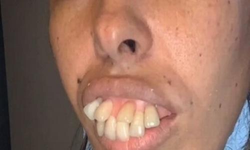 بعد أعوام من السخرية .. سيدة تجذب ملايين المتابعين بعد عملية تجميل .. صور