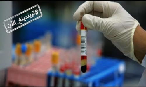 فيديو .. فيروس الصين الجديد أشد فتكا من كورونا وسببه الخنازير وليس الخفافيش