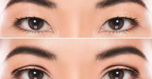 أصرت والدتها أن تكون جميلة.. طفلة 9 سنوات تخضع لعملية تجميل