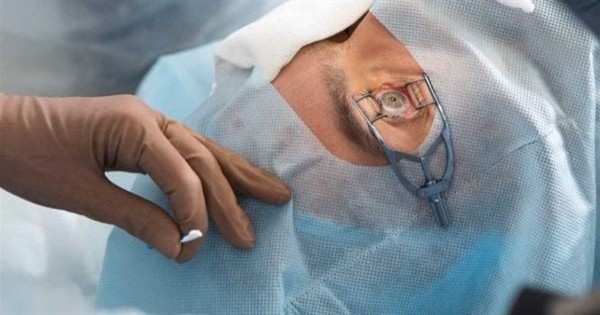علاج حول العين.. 5 طرق للقضاء على المشكلة