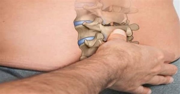 نصائح لمرضى الانزلاق الغضروفي.. تجنب الحركة والدوران المفاجئ