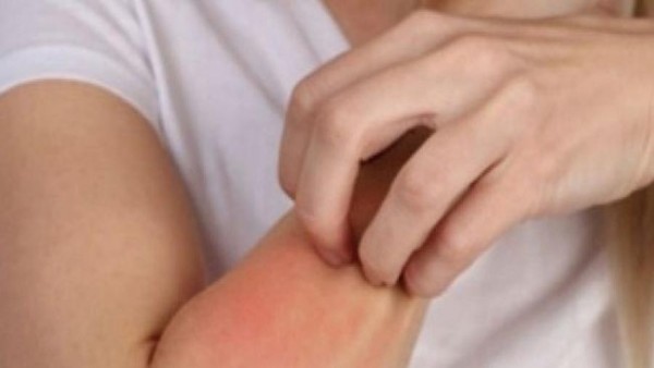 تعرف على مرض حساسية الذهب.. استشاري يوضح الأعراض وطرق الوقاية
