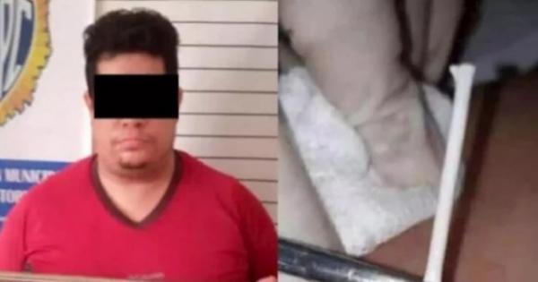طبيب مزيف فنزويلي يعالج ضحاياه بزرع "عصي المصاصات" تحت جلدهم : «خدع 25 سيدة» - صور