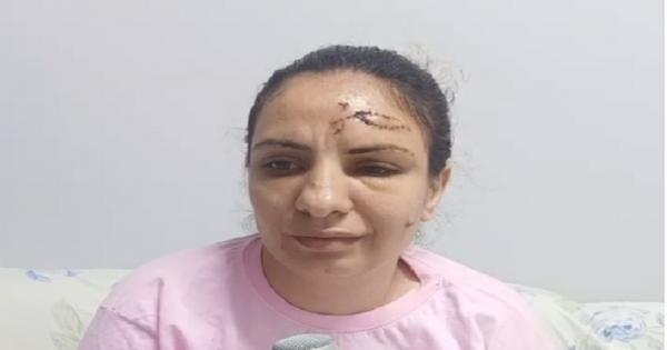 "ماري أيوب".. ضحية جديدة للعنف الأسرى في الوراق تروى تفاصيل الواقعة - فيديو