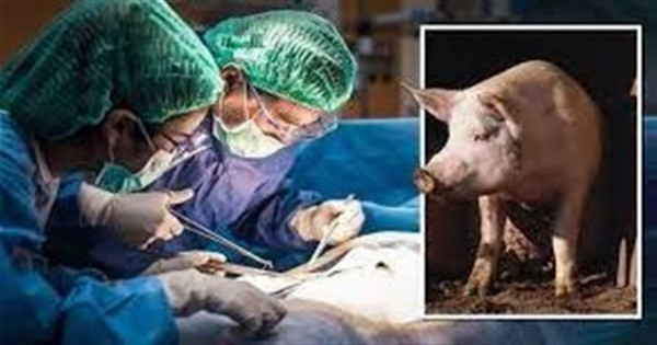 ثورة في زرع الأعضاء.. باحثون ينجحون في استعادة الدورة الدموية للخنازير الميتة
