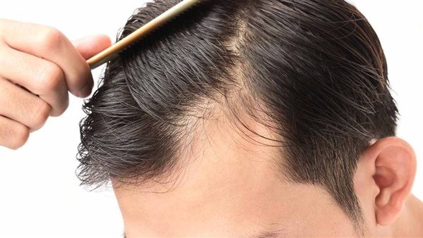 علاج تساقط الشعر عند الرجال في سن 18 عاما.. 12 نصيحة ذهبية