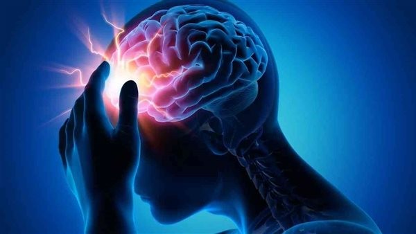 السكتة الدماغية.. الصداع من أبرز علاماتها وهذه أنواعها