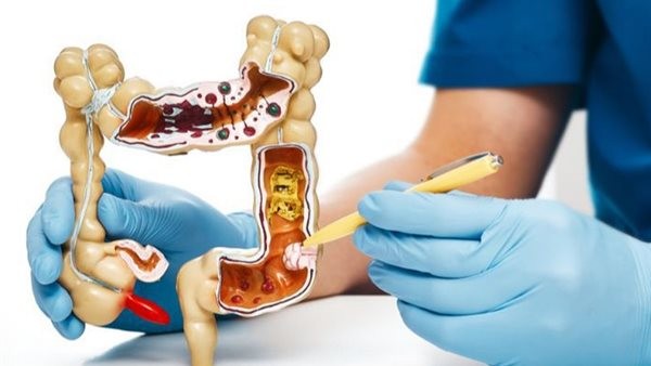 أعراض القولون الهضمي عند الرجال.. استشاري يوضح