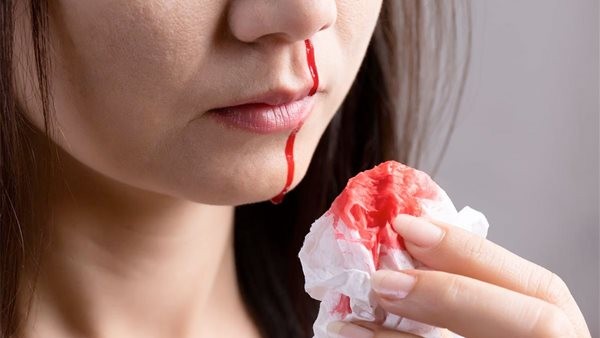 أسباب نزول الدم من فتحة واحدة بالأنف.. لماذا يجب علينا الحذر؟