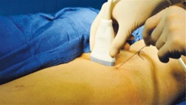 علاج ألم الفخذ المذلي.. متى نلجأ للجراحة؟