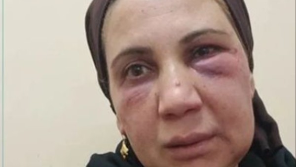 سمعت كلام ياسمين عز.. زوج يعـتدي على زوجته بالضرب في الغربية بسبب البط بالبرتقال