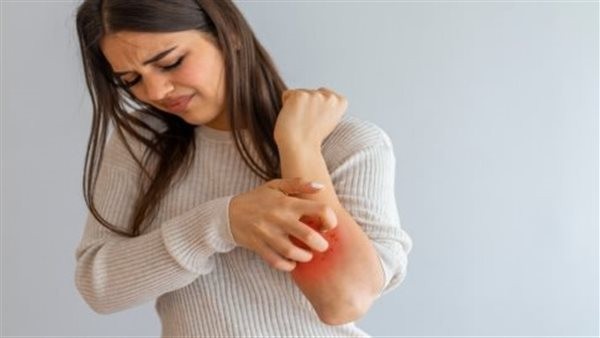 متى تكون الحكة خطيرة؟.. لا تهمل تلك الأعراض