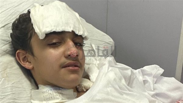 موتوسيكل هارلي.. بتر قدم طالب صدمه شاب في سباق دراجات نارية بمدينة نصر | صور