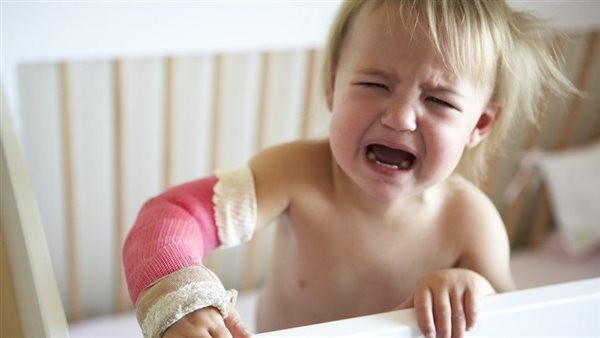 كيف تلتئم كسور العظام بسرعة؟.. جراح: احذر التدخين وكثرة المسكنات