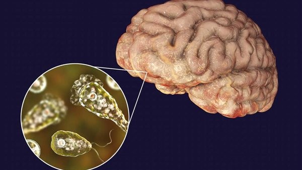 الأميبا الآكلة للدماغ.. أبرز الأعراض بعد وفاة شخص إثر استخدام مياه الحنفية