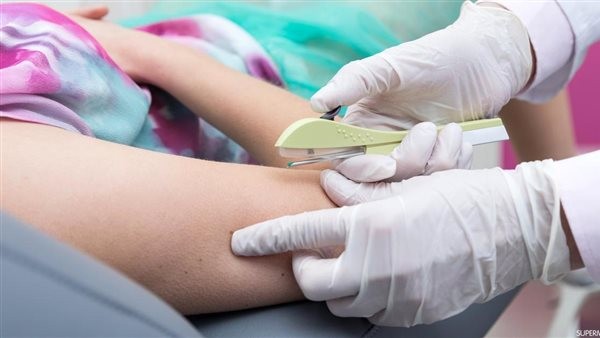 كيف يتم تركيب شريحة منع الحمل؟.. بخطوات بسيطة وغير مؤلمة