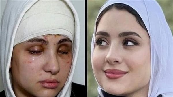 “سارة” فقدت بصرها ولكن تمسكت بحب حياتها.. خطوبة أشهر بلوجر في مصر