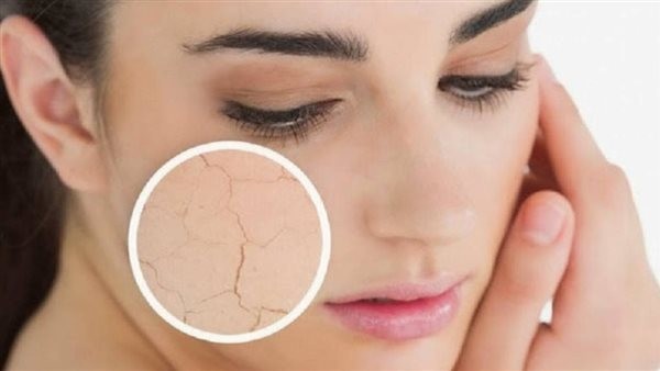 كريم لعلاج المسامات الواسعة للبشرة الدهنية.. 4 أنواع استشر طبيبك أولا