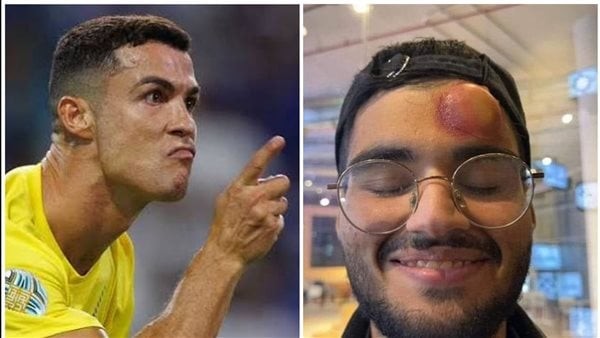 “صاروخ” أفقده الوعى| هل تسبب كرستيانو رونالدو في إصابة مصور مباراة الدوري السعودي؟| حقيقة الصورة الصادمة