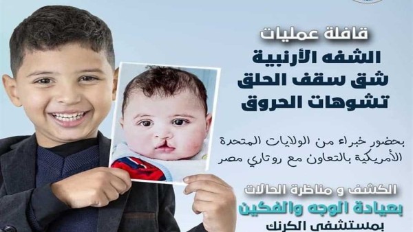 أول قافلة طبية مجانية لجراحة الشفة الأرنبية وتشوهات ما بعد الحروق في الأقصر