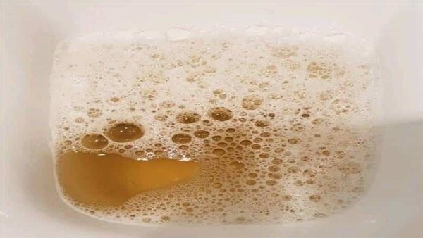 أسباب رغوة البول.. مؤشر خطير على صحة الكليتين