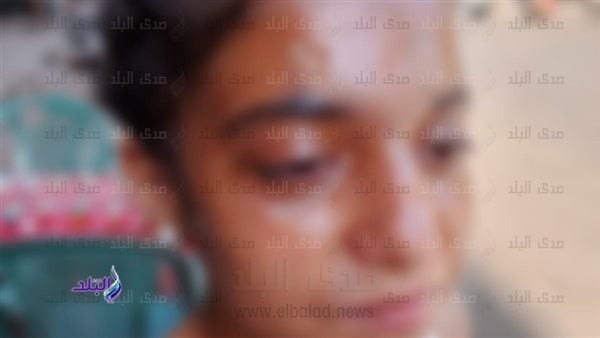 موظفة أم معلمة.. فحص الكاميرات في حادث تشويه الطفلة "كارولين" بمدرسة فيصل.. صور