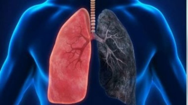 شهر التوعية بسرطان الرئة.. خطوات بسيطة تحافظ على صحة رئتيك
