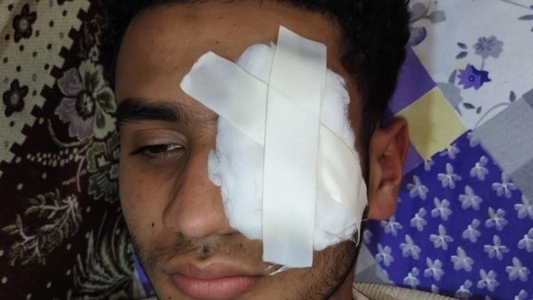 لرفضه طعن السيدات في شرفهن.. الكوارشي يعتدي على شاب ويفقأ عينه بطنطا| القصة الكاملة