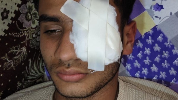 بعد رفضه لعن السيدات في شرفهن.. بطل الشهامة يفقد بصره على يد الكوارشي