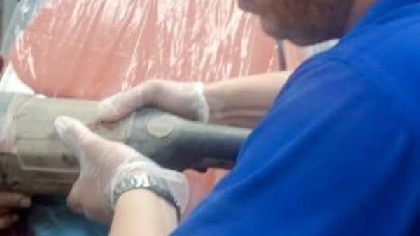 صاروخ معدني استقر في رقبته.. تفاصيل 45 دقيقة أنقذت حياة سباك من الموت