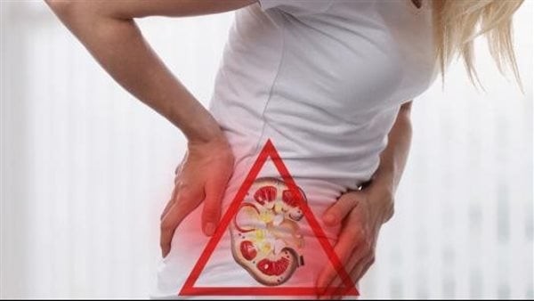 الصحة تحذر: عدم شرب الماء بكثرة في الصيف يسبب حصوات الكلى