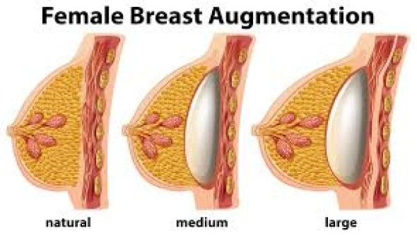 Why Breast Augmentation in Dubai Is Safer Than Ever Before