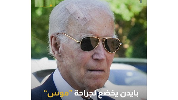 بايدن يظهر بجراحة في الرأس بعد إزالة خلايا سرطانية من جلده بتقنية "موس"
