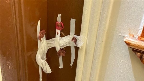 الصحة تغلق 7 عيادات تجميل وجلدية وليزر بالجيزة وسوهاج