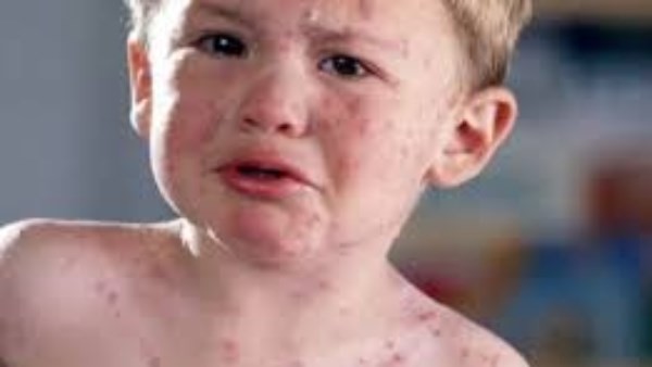 ولاية بالمكسيك تستضيف كأس العالم 2026 تعاني من تفشي مرض شديد العدوى يهدد مشجعي كرة القدم قبل المونديال