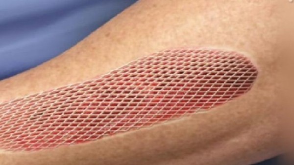 “الصحة”: مقترح التبرع بالأنسجة يتماشى مع خطة إنشاء مدينة النيل الطبية ومركز متكامل لزراعة الأعضاء